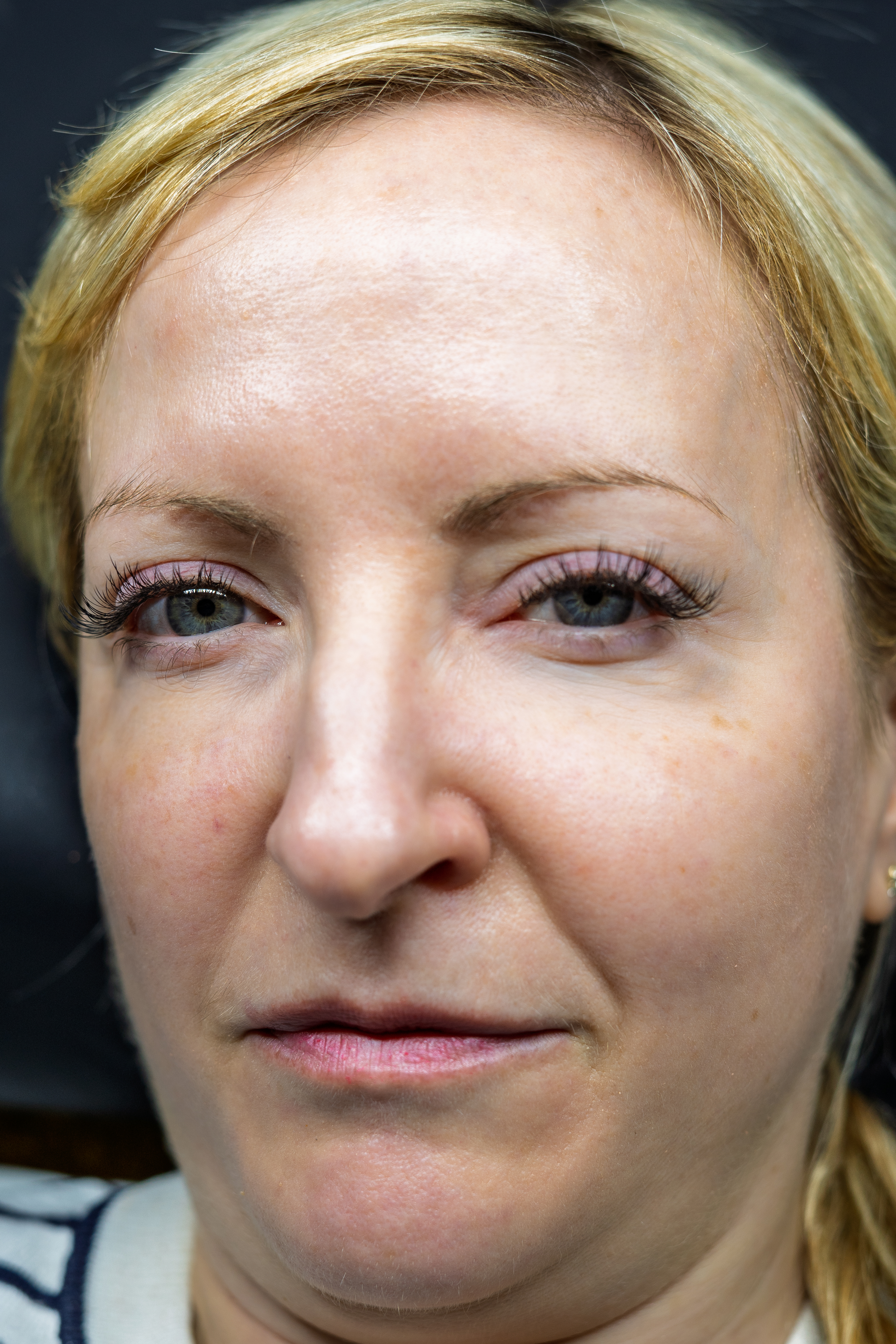 After image description