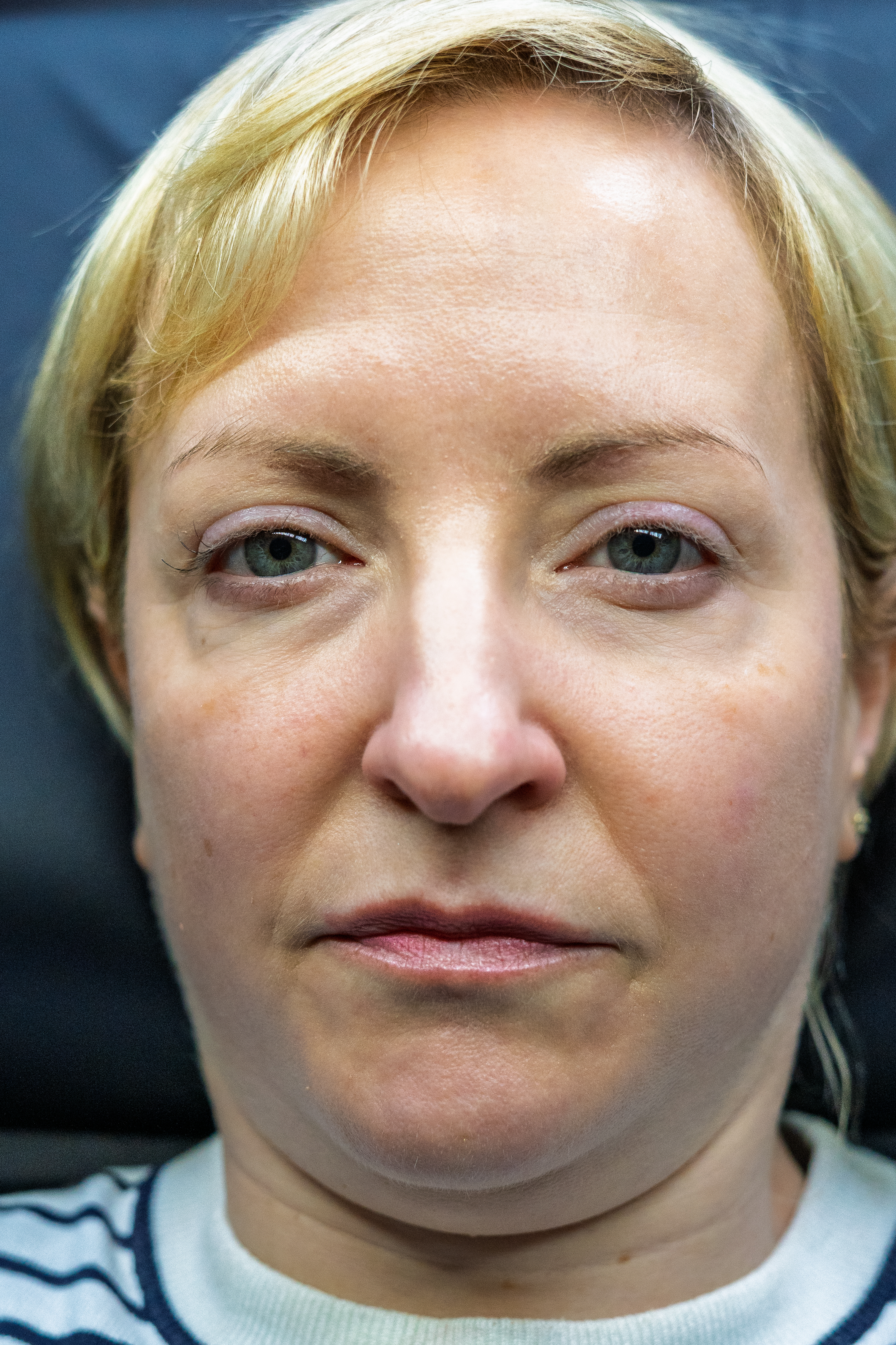 Before image description