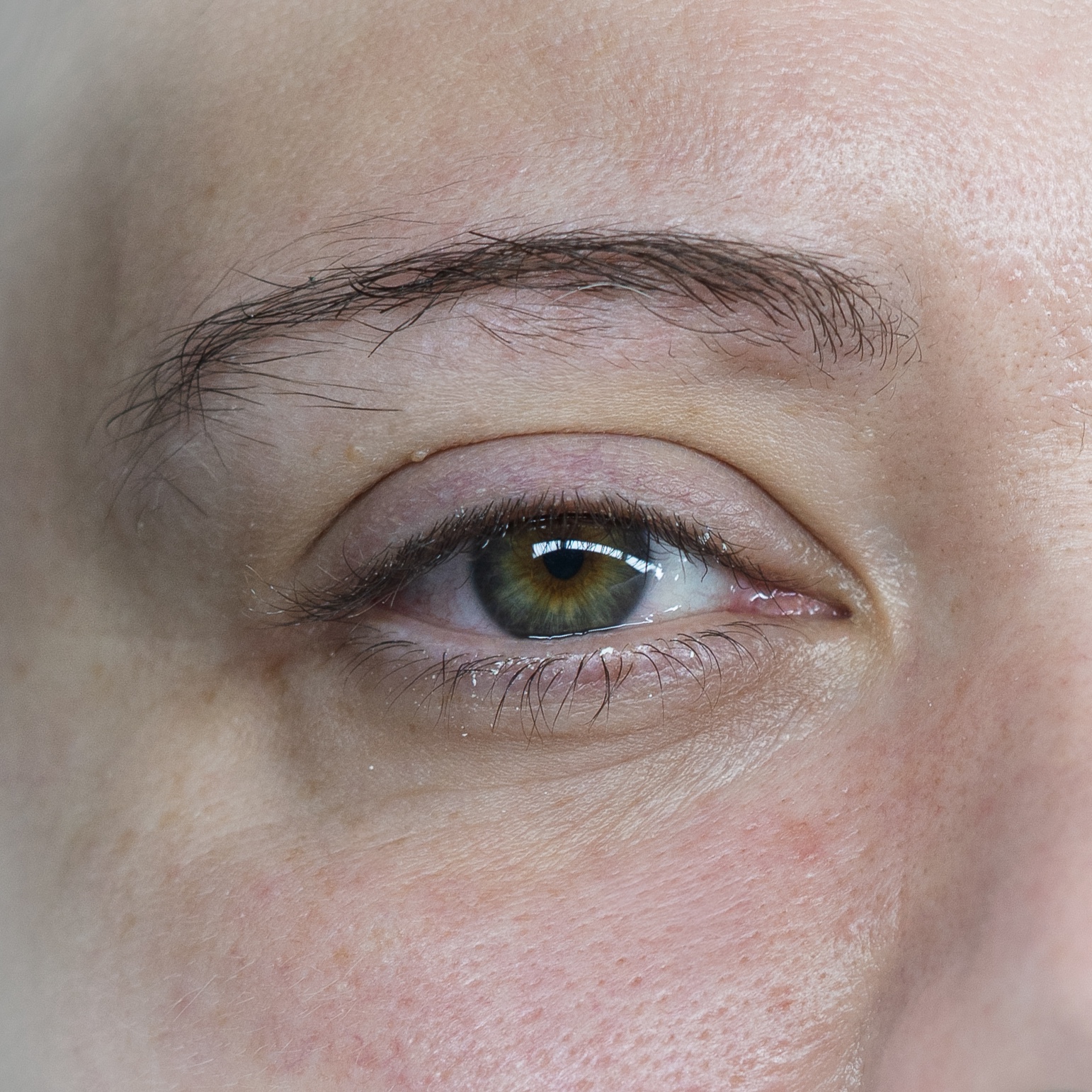 Before image description