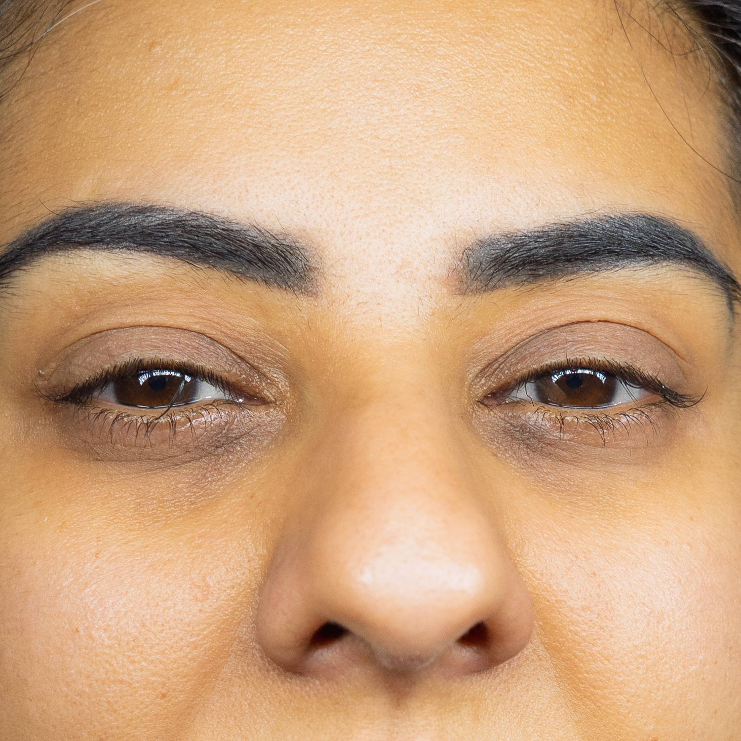 Before image description