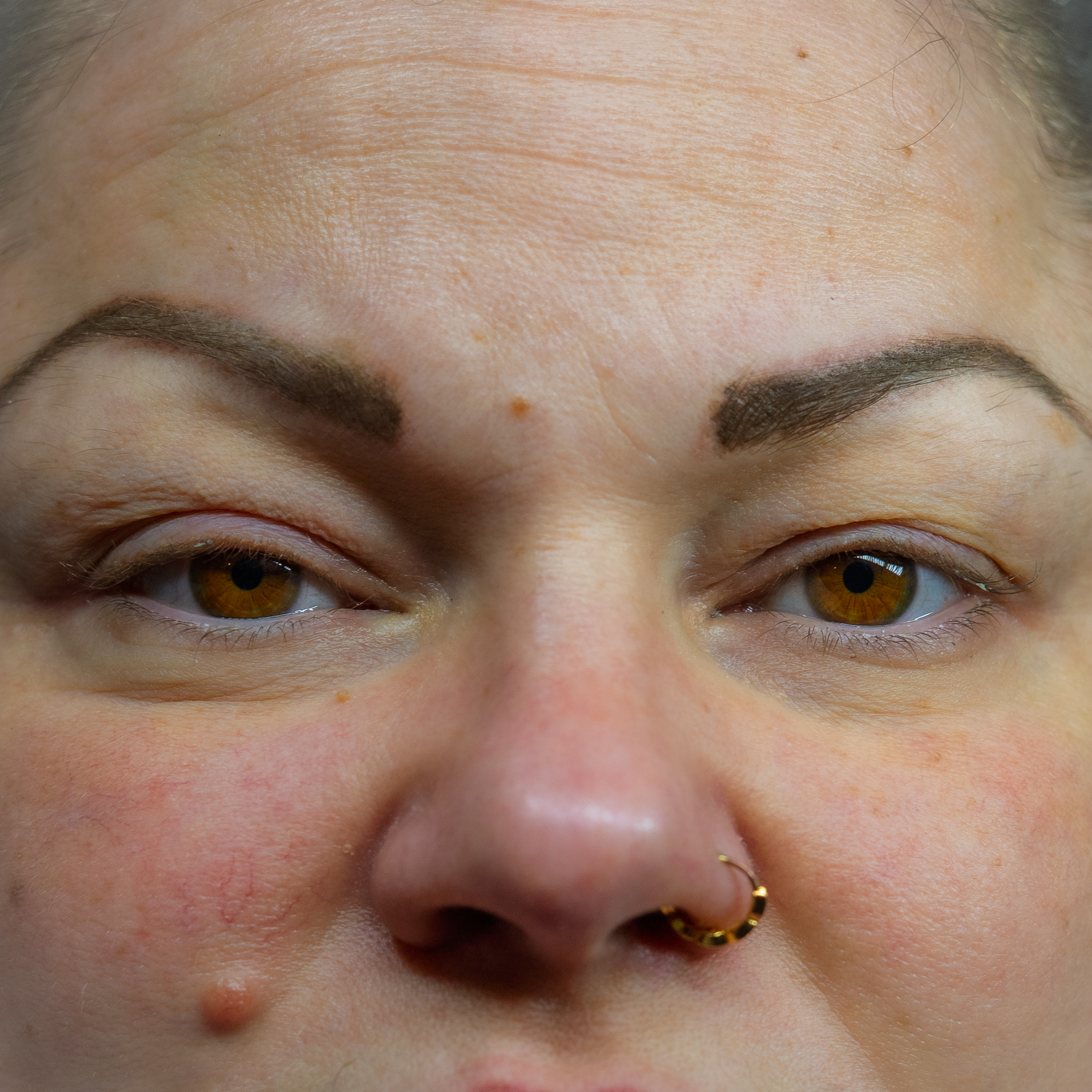 Before image description